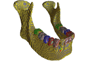mandibul2